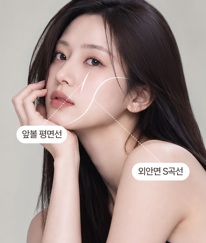 앞볼 평면선과 외안면 S곡선을 표시한 모델 사진 1