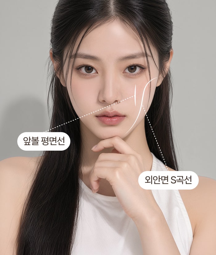 앞볼 평면선과 외안면 S곡선을 표시한 모델 사진 2