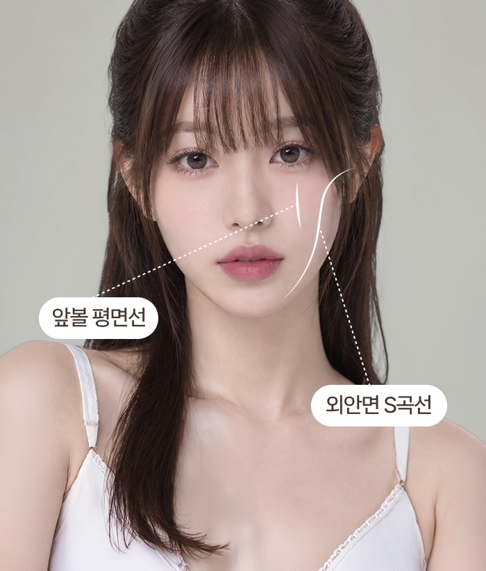 앞볼 평면선과 외안면 S곡선을 표시한 모델 사진 3